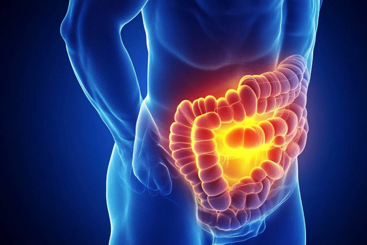 7 Warning Signs of Colon Cancer You Should Never Ignore!