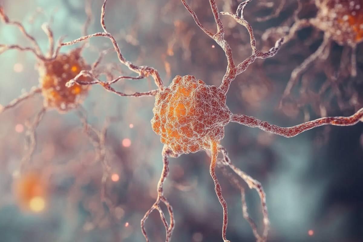 Parkinson: Recent Advances in Genetic Research