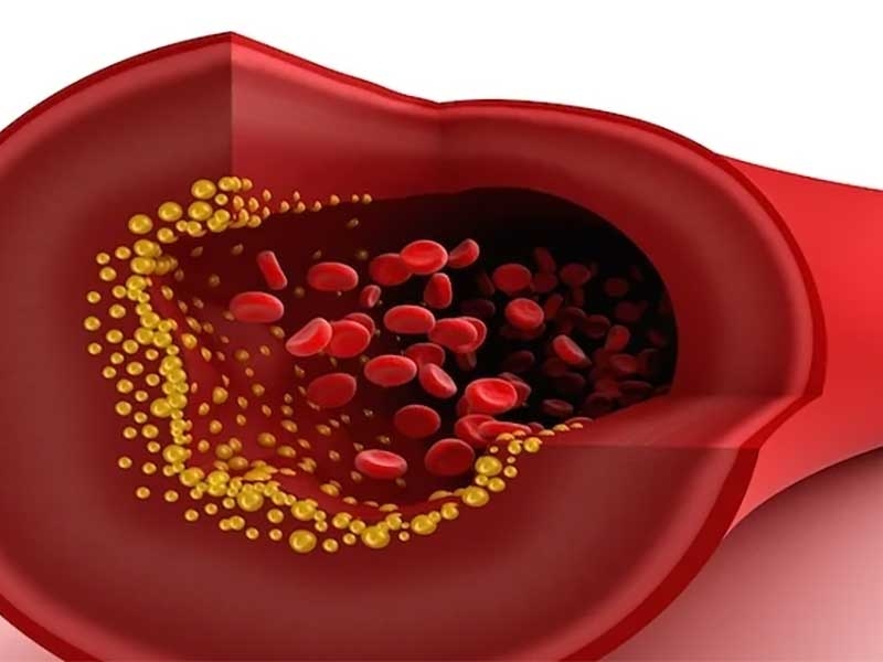 Total Cholesterol Test